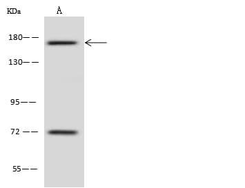 Polyclonal Rabbit anti-Human TBC1D9B Antibody (WB)