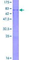 Human PFKFB2 Protein (Recombinant GST)