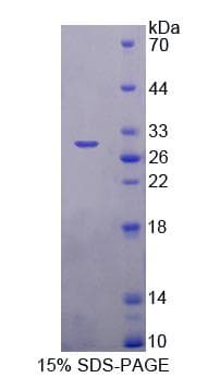 Human ITGB6 / Integrin Beta 6 Protein (Recombinant His-T7)