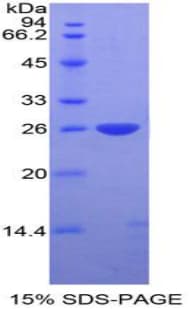 Mouse DIXDC1 Protein (Recombinant His-T7)