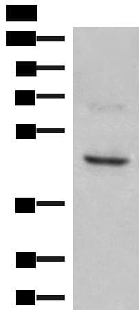 NCR1 / NKP46 Antibody