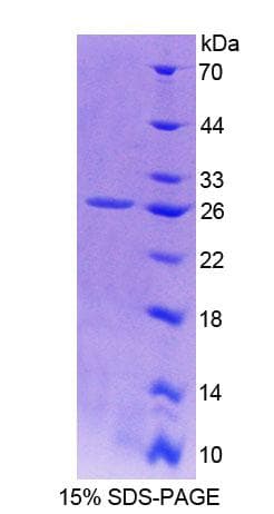 Human SPA17 / Sperm Protein 17 (Recombinant His-T7)
