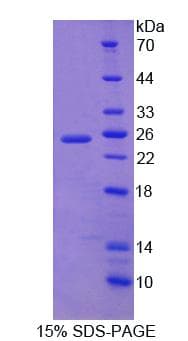 Mouse DTNBP1 / Dysbindin Protein (Recombinant)