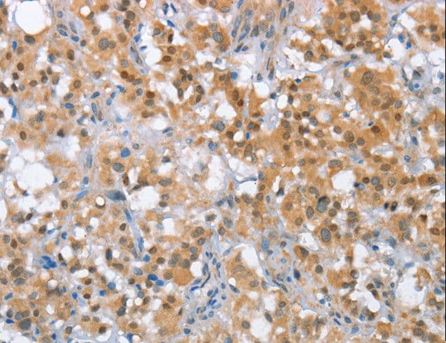 Polyclonal Rabbit anti-Human MLH1 Antibody (IHC)