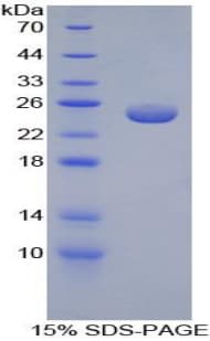 Mouse PRDX5 / Peroxiredoxin 5 Protein (Recombinant His)