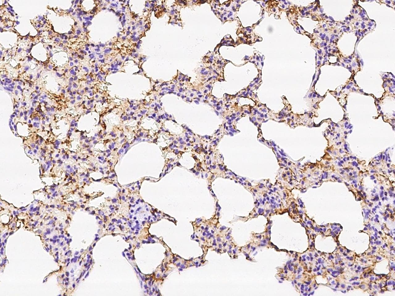 C1qRP / CD93 Antibody (Preservative Free)