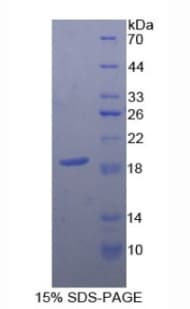 Human CD59 Protein (Recombinant His-S)