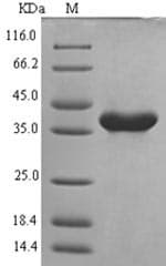 Mouse NALP3 / NLRP3 Protein (Recombinant 6His-SUMO, N-terminus)