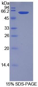 Mouse HAO1 Protein (Recombinant His-GST)