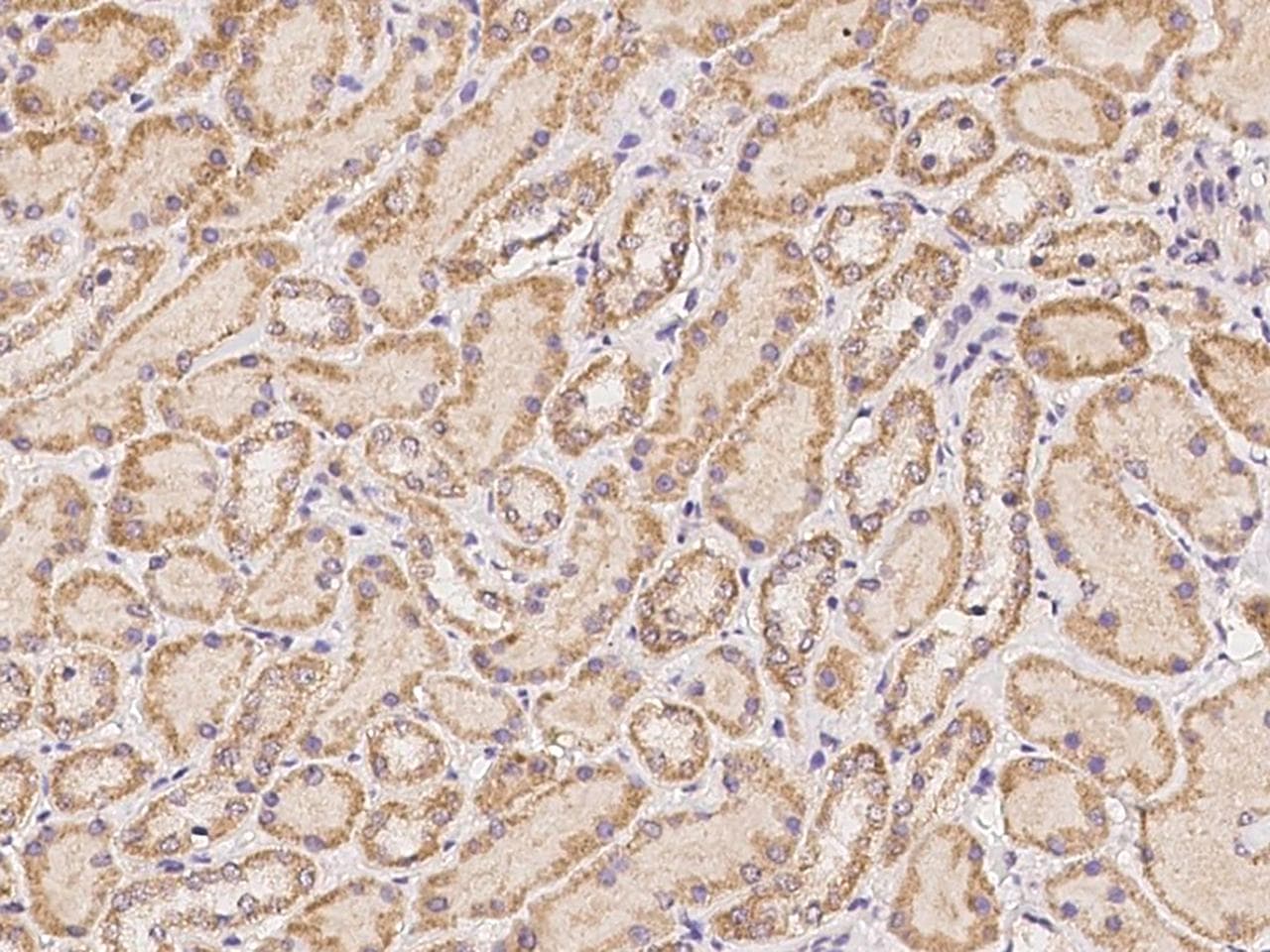 Polyclonal Rabbit anti-Human GABPB2 Antibody (IHC)