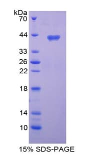 Human LD78 / CCL3L1 Protein (Recombinant His-GST)