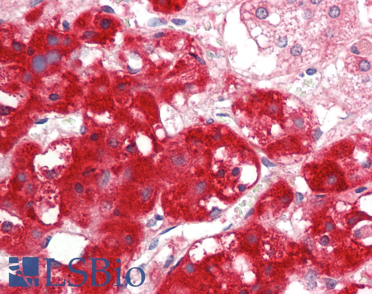 IFRD1 / TIS7 Antibody (aa38-87)