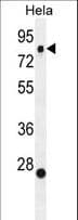 Polyclonal Rabbit anti-Human SSH3 Antibody (aa575-602, IHC, IF, WB)