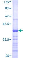 Human FCGR1A / CD64 Protein (Recombinant GST, N-terminus)