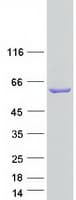 Human FMO3 Protein (Recombinant Myc-DDK (Flag))