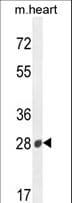 B3GAT2 Antibody (aa123-150)