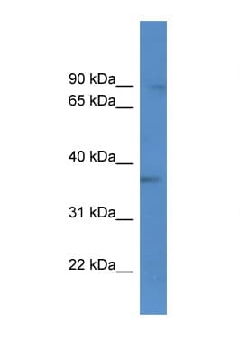 MGC11296 / BRMS1L Antibody (aa181-230)