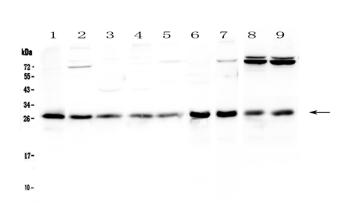 Polyclonal Rabbit anti-Human RAB27A / RAB27 Antibody (IHC, WB)