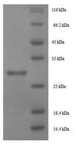 Lepidoglyphus destructor Mite group 2 allergen Lep d 2 Protein (Recombinant 6His-SUMO, N-terminus)