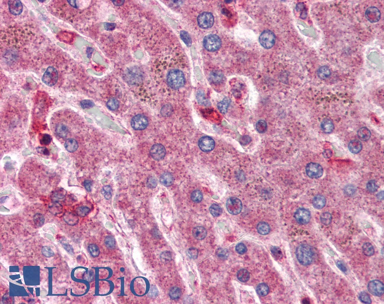 IHC-plus™ Polyclonal Goat anti-Human HYAL1 Antibody (aa325-339, IHC, IF)