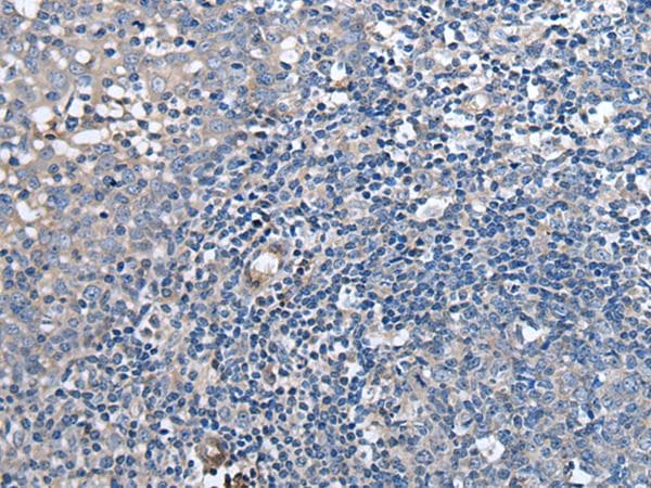 F3 / CD142 / Tissue factor Antibody