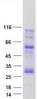 Human MOG Protein (Recombinant Myc-DDK (Flag))