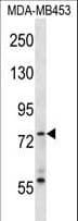 Polyclonal Rabbit anti-Mouse SYK Antibody (aa195-223, WB)