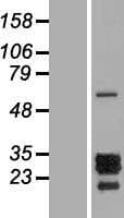 Human PTHLH / PTHRP Protein (Over-Expression Lysate Myc-DDK (Flag))