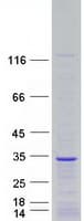 Human FGF12 Protein (Recombinant Myc-DDK (Flag))