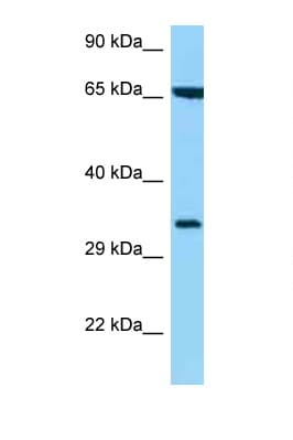 HLA-C Antibody (aa208-257)