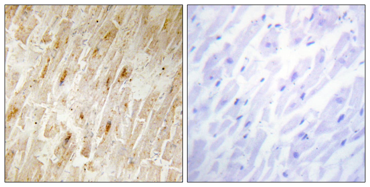 AKIP1 / BCA3 Antibody (aa111-160)