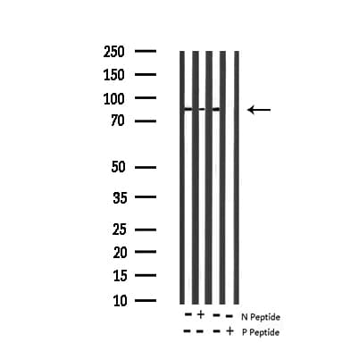 MAPT / Tau Antibody (phospho-Ser396)