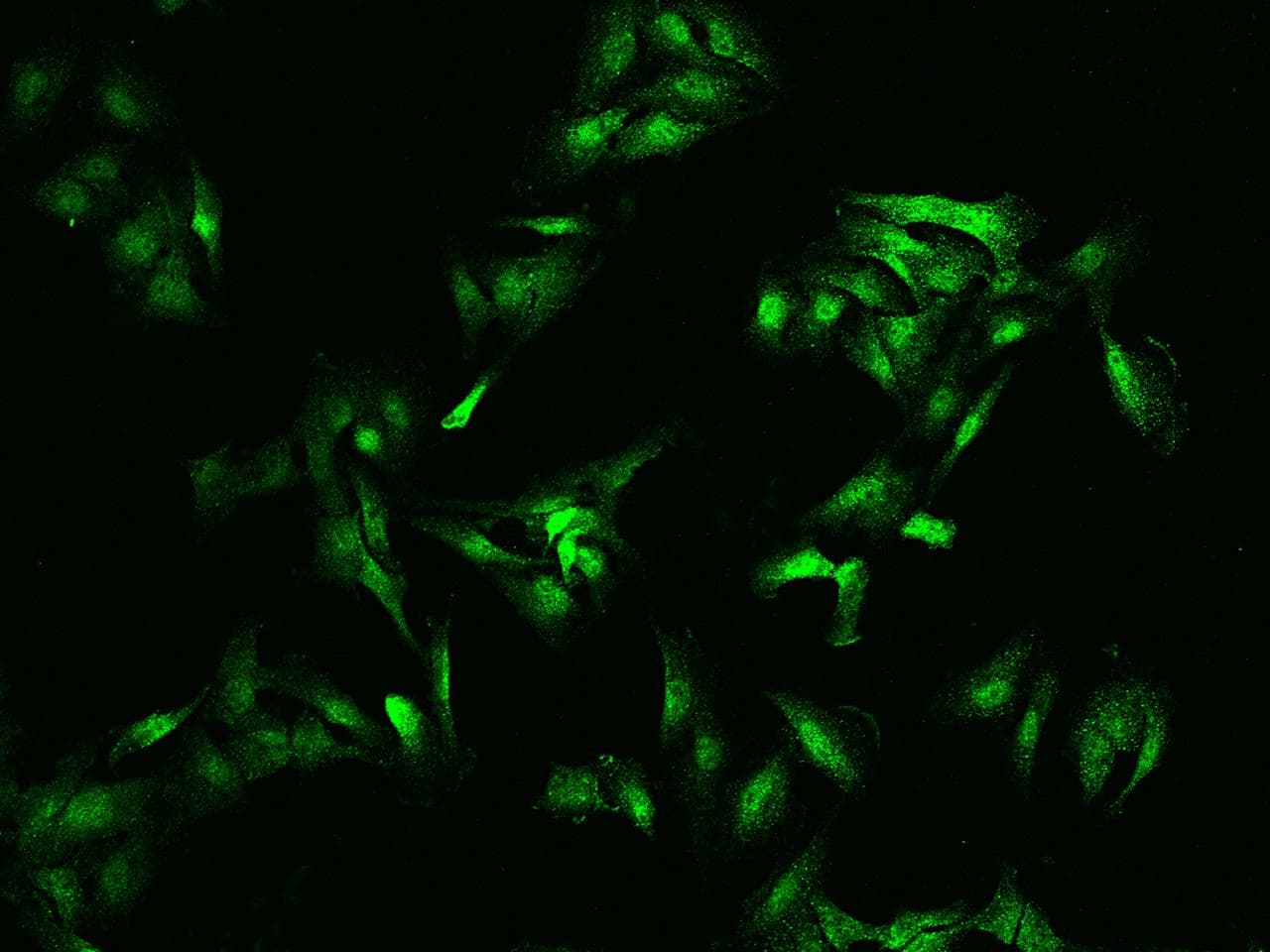 Polyclonal Rabbit anti-Human TNNI2 Antibody (Preservative Free, IHC, IF, WB)