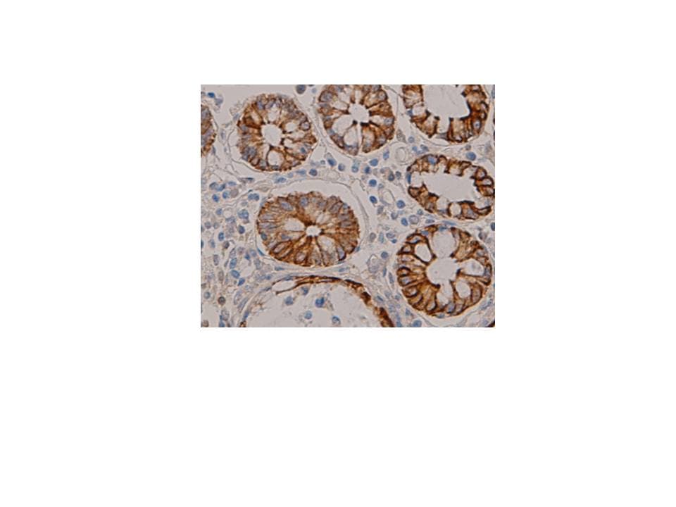 KRT8 / CK8 / Cytokeratin 8 Antibody