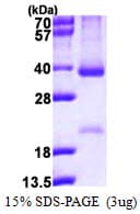 Human CCND2 / Cyclin D2 Protein (Recombinant His)