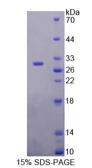 Human DIXDC1 Protein (Recombinant His-T7)