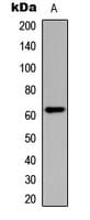CHEK2 / CHK2 Antibody (phospho-Thr383)