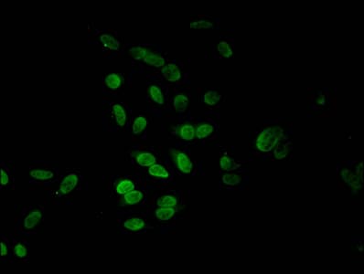 HIST1H4I Antibody