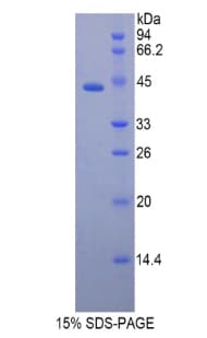 Rat LL37 / Cathelicidin Protein (Recombinant His-GST)