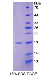 Rat AIF1 / IBA1 Protein (Recombinant His)