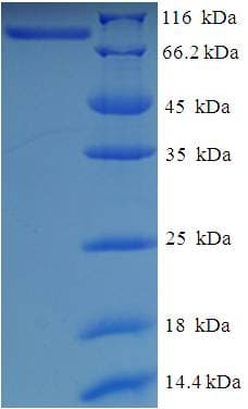 Human CEP83 / CCDC41 Protein (Recombinant His-SUMO)