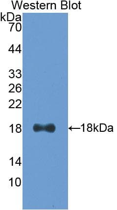 IFN Gamma / Interferon Gamma Antibody (aa24-166, PE)