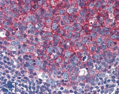 IHC-plus™ CD82 Antibody (clone C33)