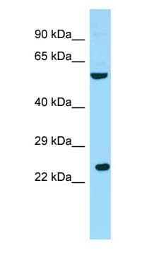 Polyclonal Rabbit anti-Human RGS9BP Antibody (N-Terminus, WB)