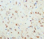 NGF Antibody (N-Terminus)