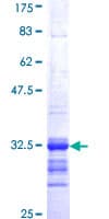 Human SSTR2 Protein (Recombinant GST, N-terminus)