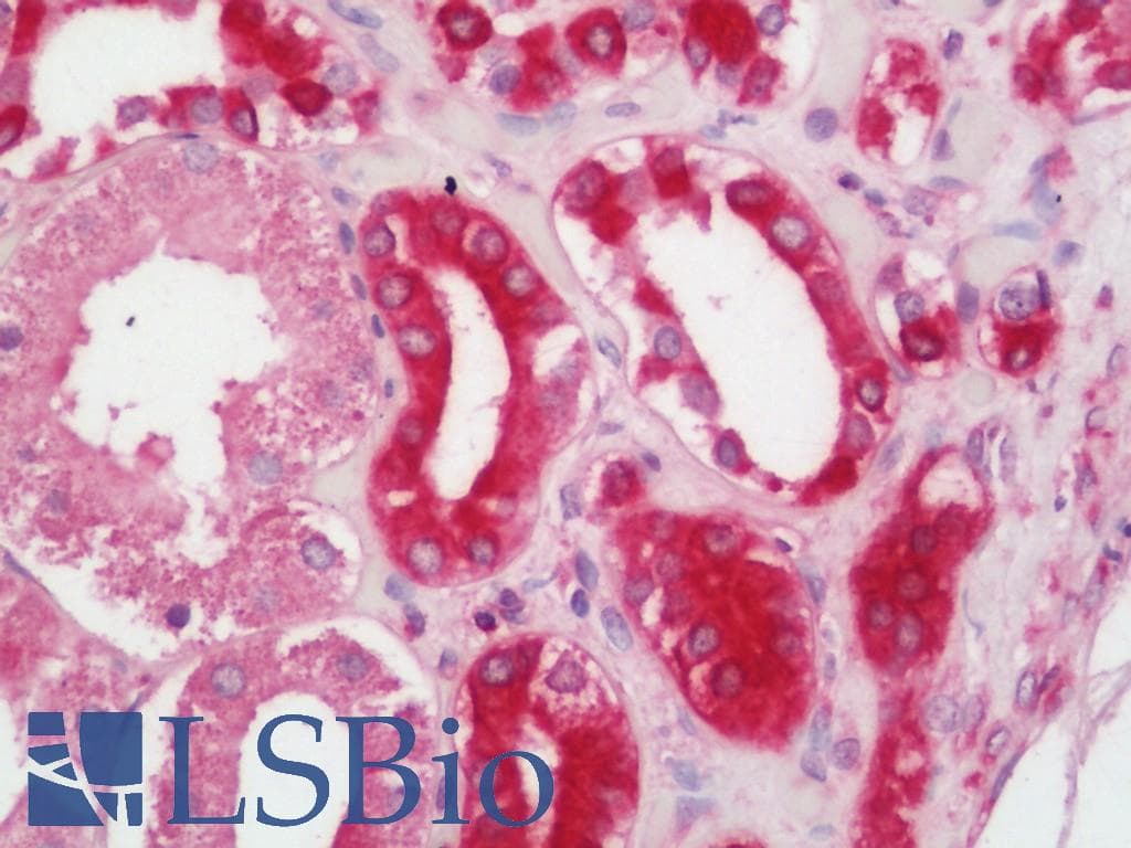 IHC-plus™ STUB1 / CHIP Antibody (aa253-303)