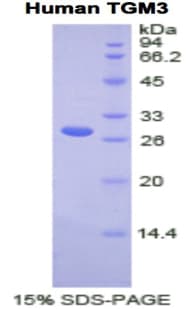 Human TGM3 / Transglutaminase 3 Protein (Recombinant His)