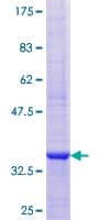 Human CRP / C-Reactive Protein (Recombinant GST)