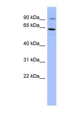 ZNF778 Antibody (N-Terminus)